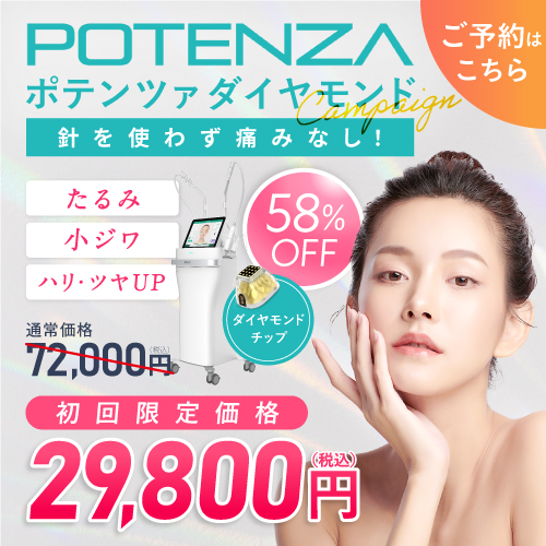 ポテンツァダイヤモンドキャンペーン