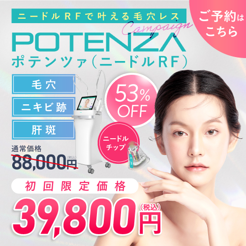 ポテンツァキャンペーン