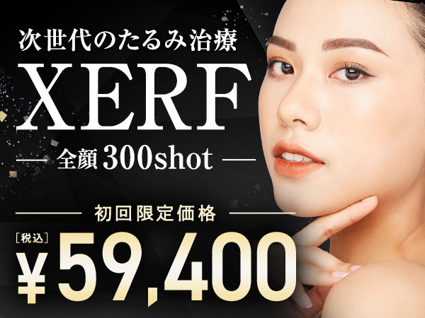 XERF（ザーフ）キャンペーン