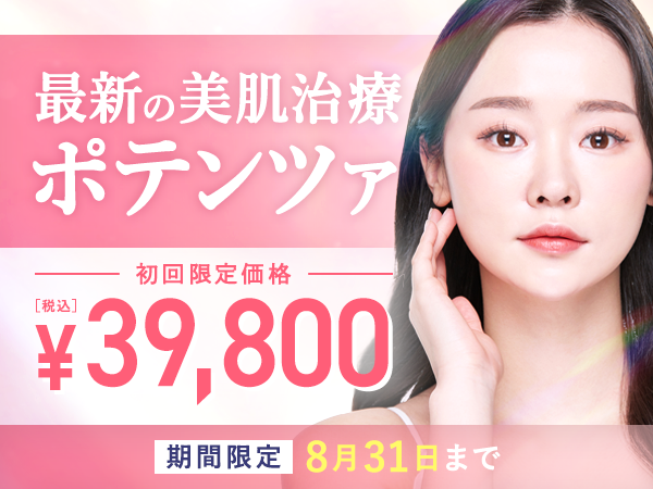 ポテンツァキャンペーン